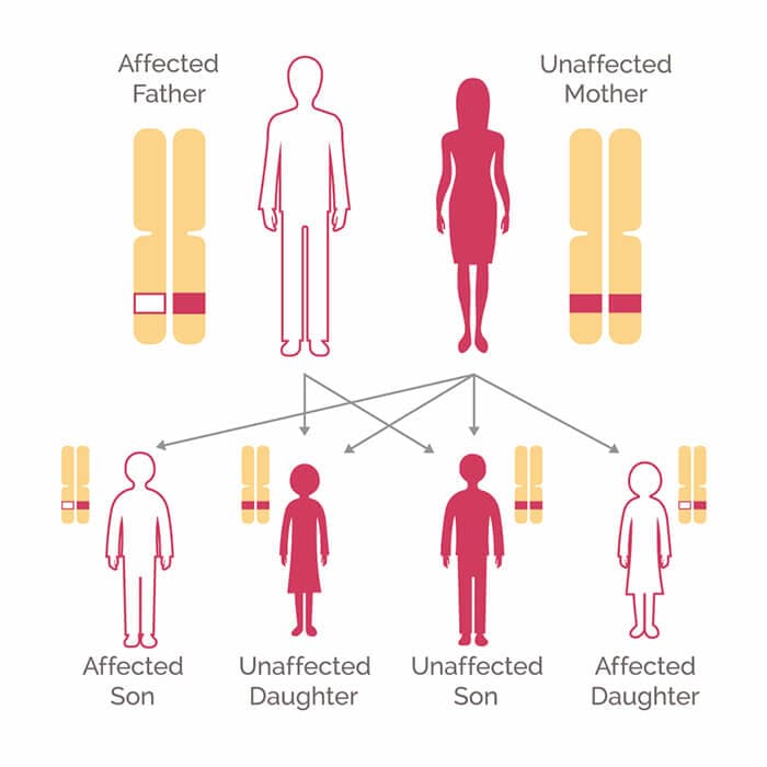 BRCA genetic testing for hereditary cancer